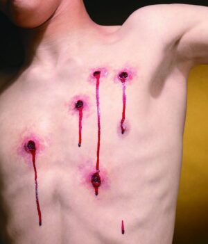 Bullet Wounds