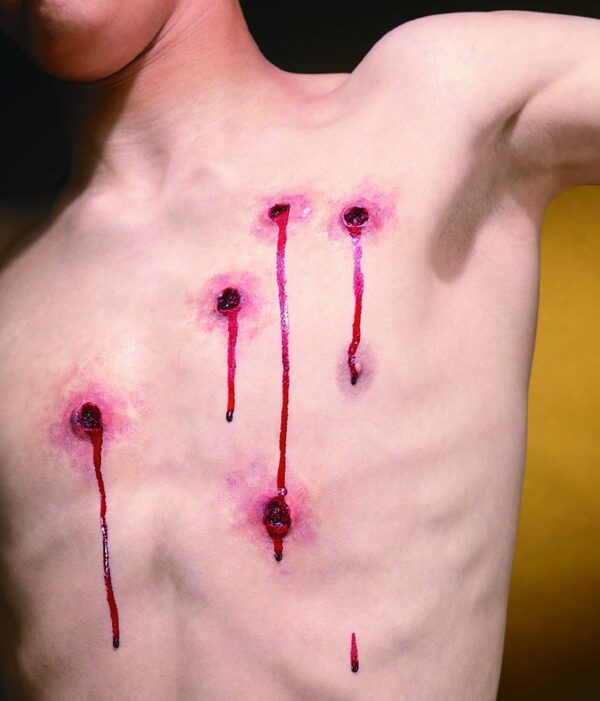Bullet Wounds