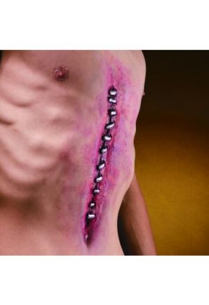 Malpractice